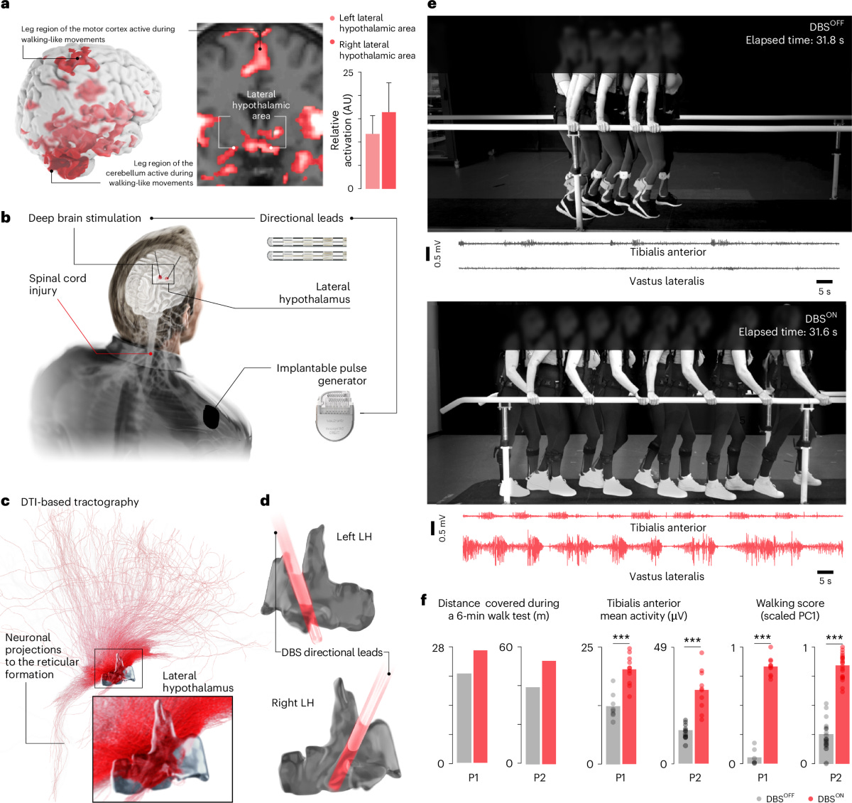 Hypothalamic deep brain stimulation augments walking after spinal cord  injury | Nature Medicine