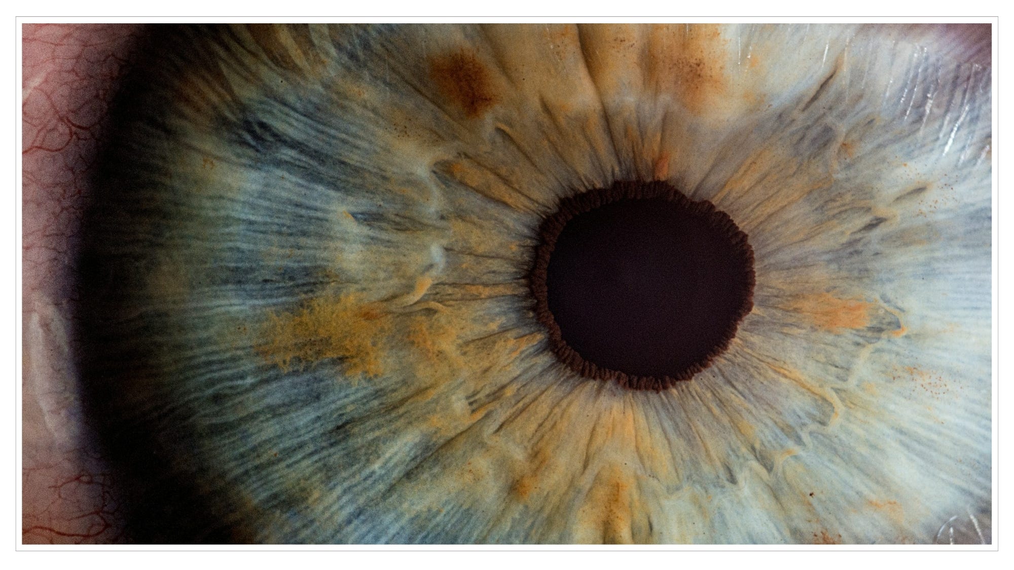 Iris & pupil of eye
