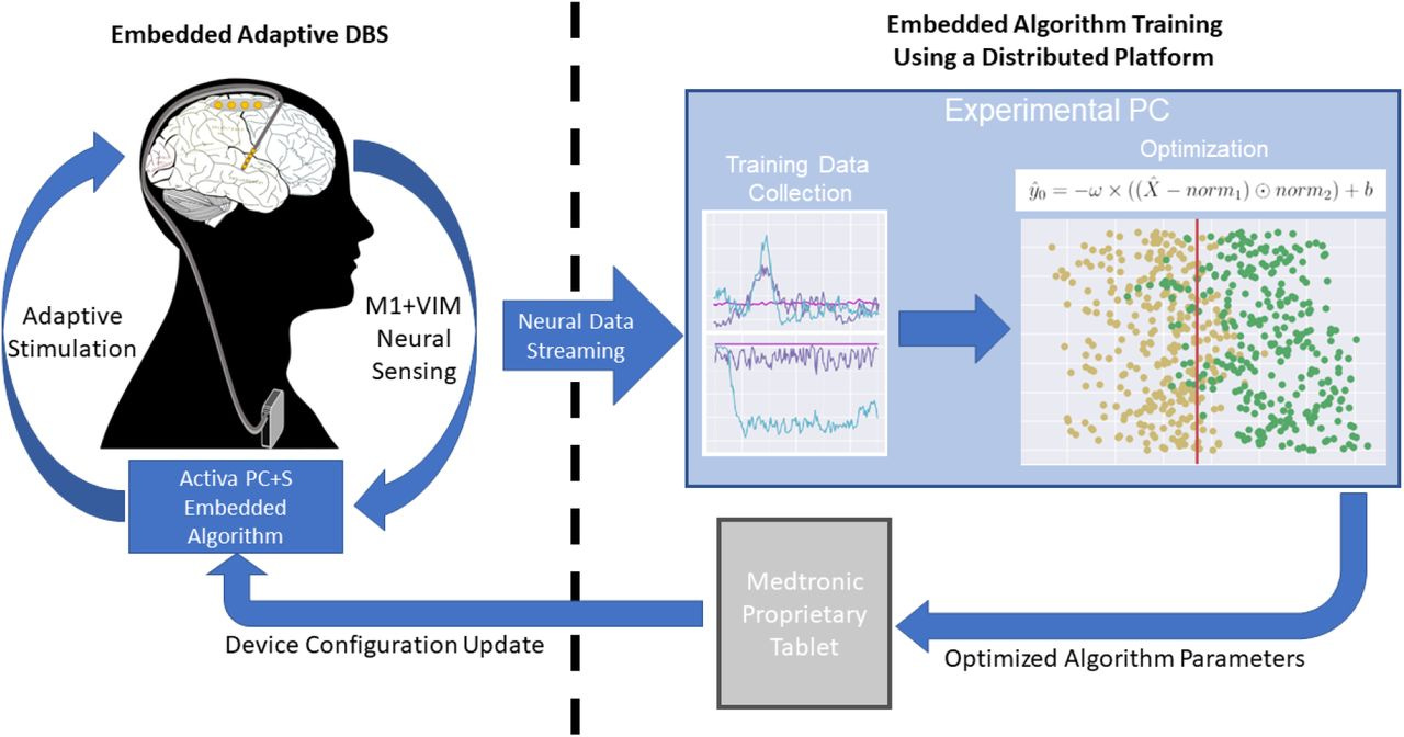 Fully implanted adaptive deep brain stimulation in freely moving essential  tremor patients | medRxiv