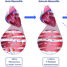 Heart Fibrosis caused by Endotoxin