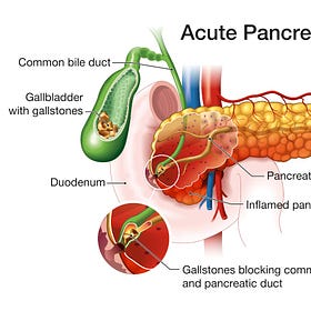 Covid19 Jab Pancreas Damage link to Endotoxin