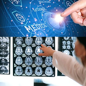 How artificial intelligence is advancing medical device innovation