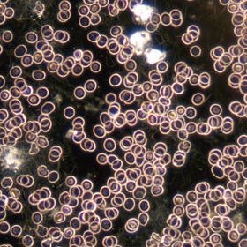 Darkfield Liveblood Analysis