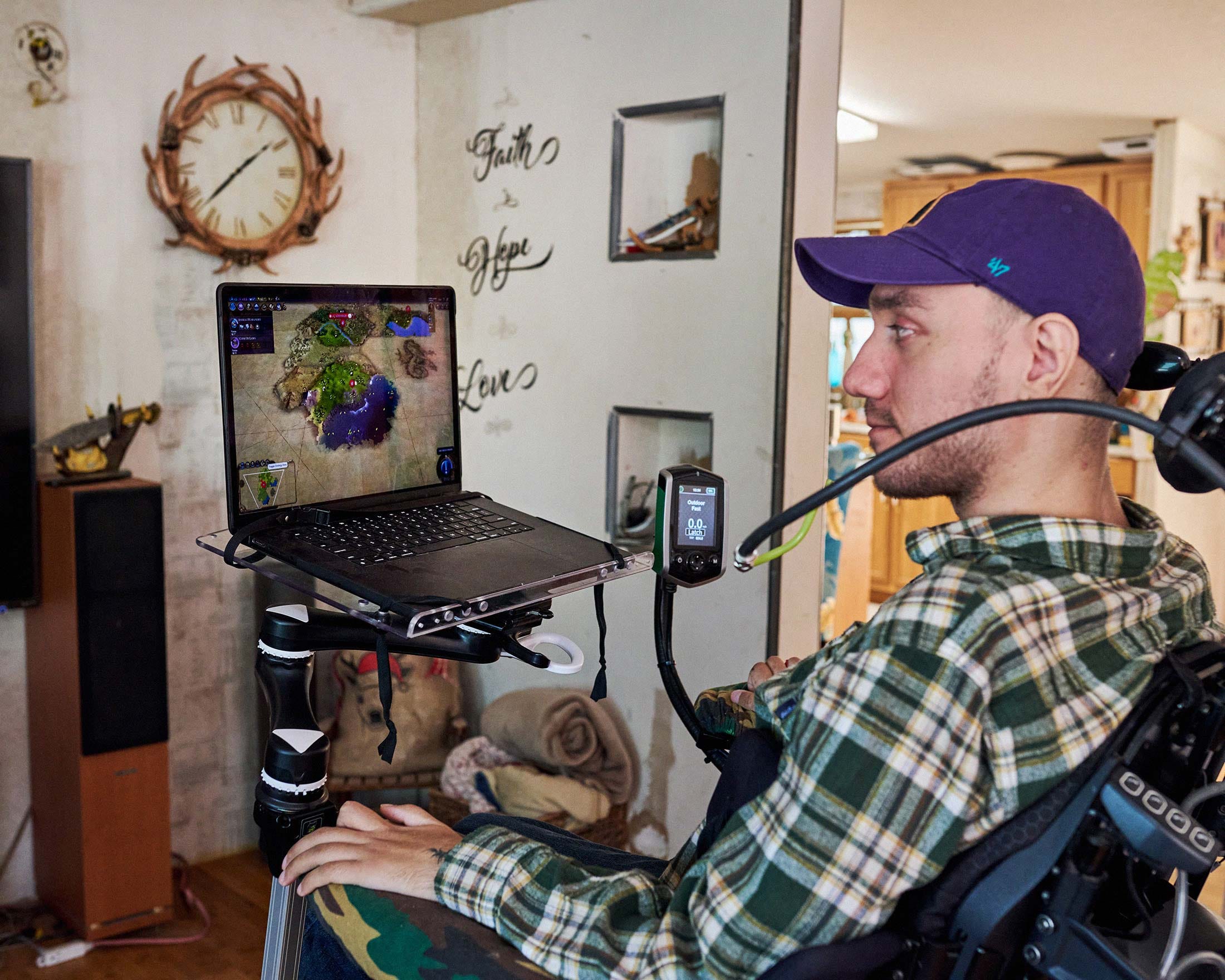 The implant allows Arbaugh to play computer games with relative ease.