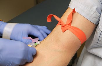 Straight needle accessing the cephalic vein