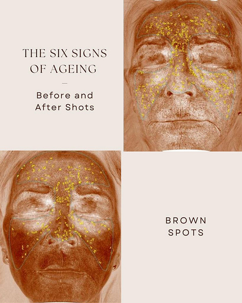The Rejuvenator facial targets fine lines and open pores, reduces sun spots, red spots, brown spots, and improves a smoother more even texture.