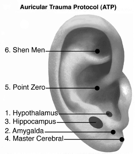 Psychic areas of earlobe