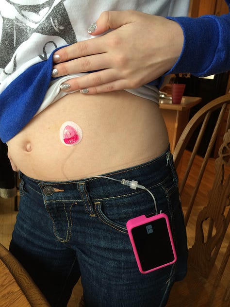 Insulin pump on table; pump hooked to jeans pocket and attached to stomach through tube; Girl eating cookie, smiling, and holding insulin pump.