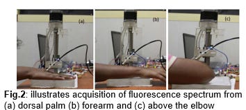 Transdermal Collagen and Hemoglobin Sensor