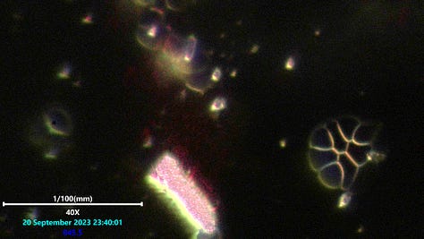 Laser microscopy of wavy patterns phenomena observeed in a polymerized structure from blood