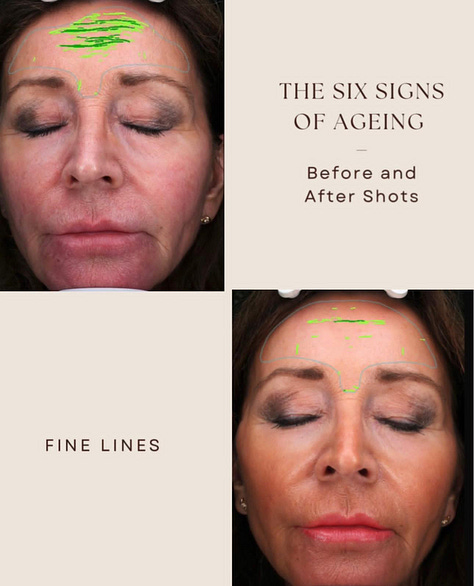 The Rejuvenator facial targets fine lines and open pores, reduces sun spots, red spots, brown spots, and improves a smoother more even texture.