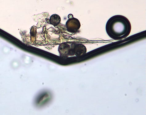 Various Microcapsules taken from various samples using a lab grade LeicaDM2000 microscope at 25x objective and enlarged significantly
