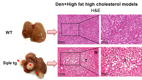 Terbinafine, a Novel Therapeutic Drug in the Treatment of Liver Cancer