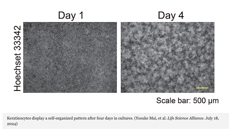 Starvation and Adhesion Drive Formation of Keratinocyte Patterns in Skin