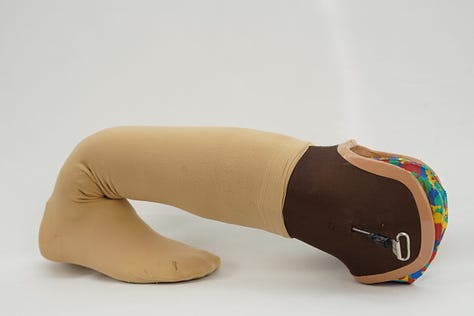 MyB Prosthetic Limb