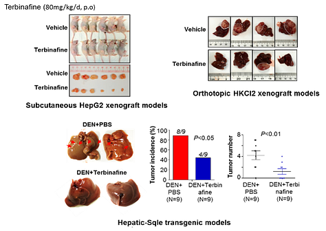 Terbinafine, a Novel Therapeutic Drug in the Treatment of Liver Cancer