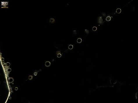 lIpid droplets forming on a string of something in open blood plasma