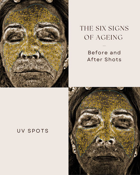 The Rejuvenator facial targets fine lines and open pores, reduces sun spots, red spots, brown spots, and improves a smoother more even texture.