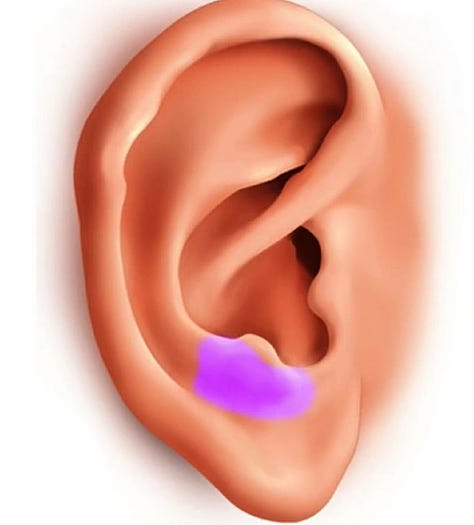 Psychic areas of earlobe