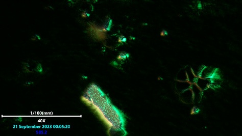 Laser microscopy of wavy patterns phenomena observeed in a polymerized structure from blood