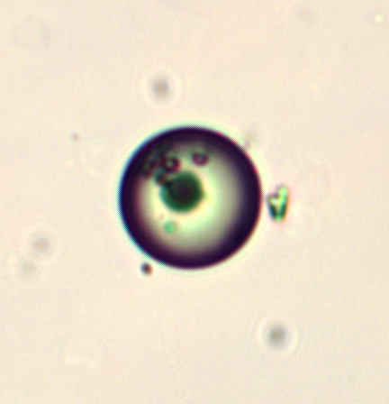 Various Microcapsules taken from various samples using a lab grade LeicaDM2000 microscope at 25x objective and enlarged significantly