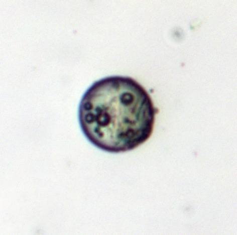 Various Microcapsules taken from various samples using a lab grade LeicaDM2000 microscope at 25x objective and enlarged significantly