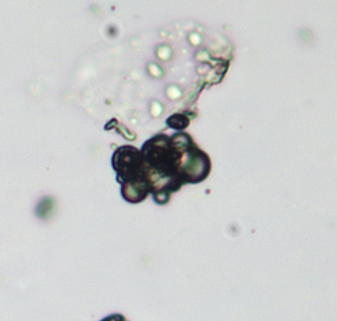 Various Microcapsules taken from various samples using a lab grade LeicaDM2000 microscope at 25x objective and enlarged significantly