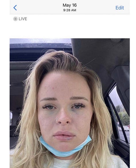 Trevor Bauer's rape accuser Lindsey Hill releases photos