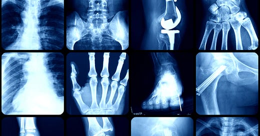 Things Hidden In Complexity Moriarty Substack