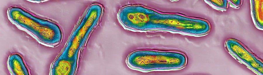Clostridium Botulinum Bacteria Photograph by James Cavallini - Pixels