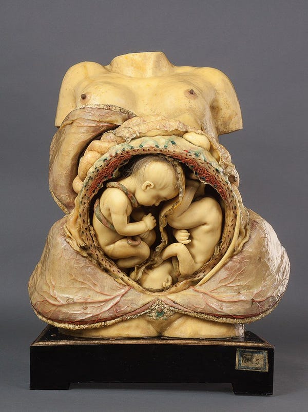A wax model from the 18th century that depicts a woman's torso which has been dissected to reveal twins in her uterus. 
