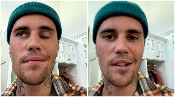 Justin Bieber