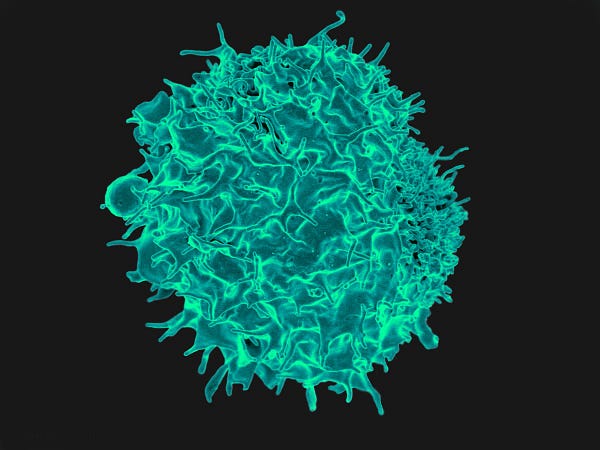 Scanning electron micrograph of a T cell.