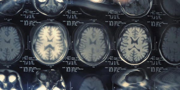Why the Future of Medicine is Hiding in Your Tears