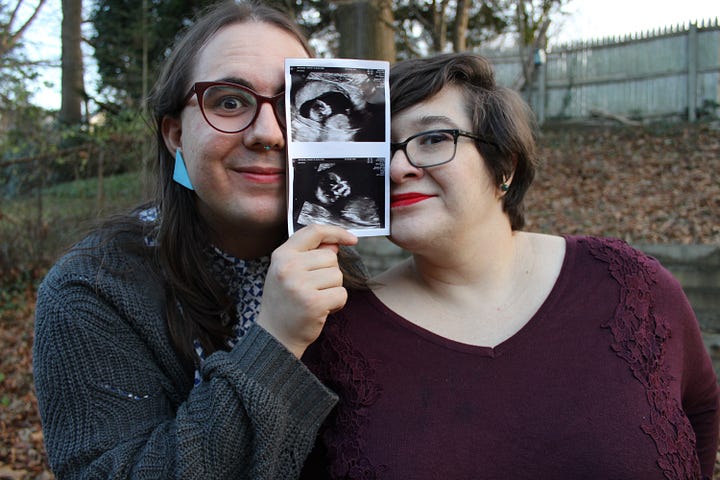 Lyndsey and Jade are holding the 18-week ultrasound of their baby-to-be. In one photo, they both are smiling with their mouths open, with excited expressions on their faces. Lyndsey is pointing at the ultrasound. In the second, they're holding the ultrasound between them and peering out from behind the ultrasound. 