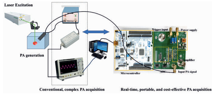 Fast Cancer Screening Device for Early-stage Cancer Diagnosis, using a Quantitative Photoacoustic Spectral Response Technique