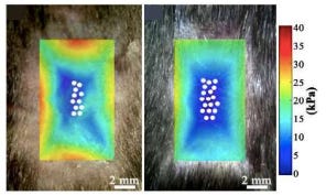 Mechanotransduction Inhibitors for Preparation of Hair Follicle