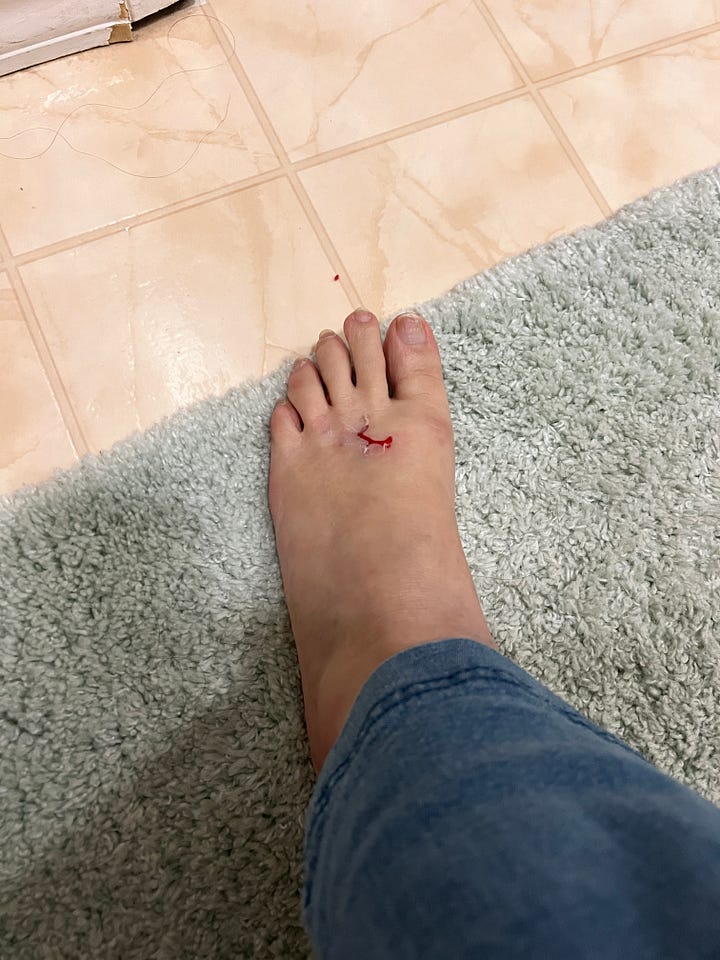 image of injured foot, unbandaged and bandaged