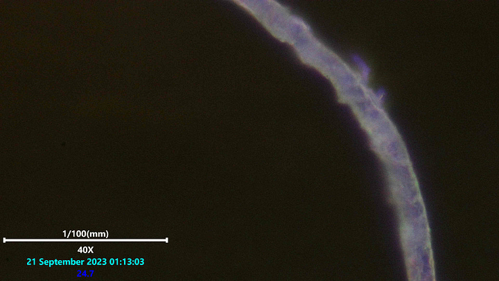 Laser scanning microscopy of polymer based fiber in blood showing the wavy pattern phenomena