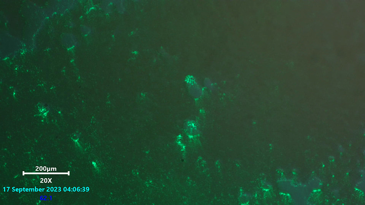 Laser scanning microscopy of blood showing ring constructors and meta material like phenomena located inside (bright wavy area).