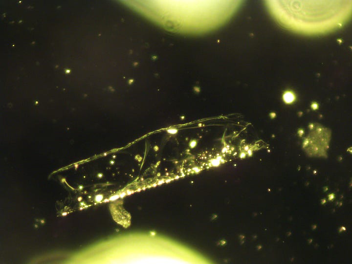 Images taken of blood samples using Fluorescein disodium dye and taken with the 5MP camera.