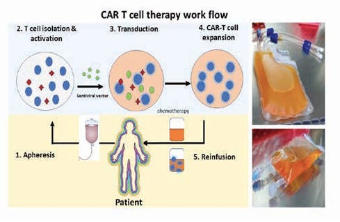 CAR-T Cell Therapy (Gene Therapy) to Cure Cancer