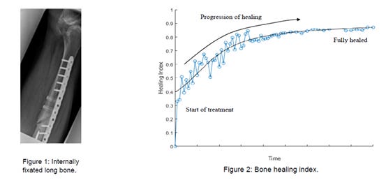 Bone Healing Assessment Device