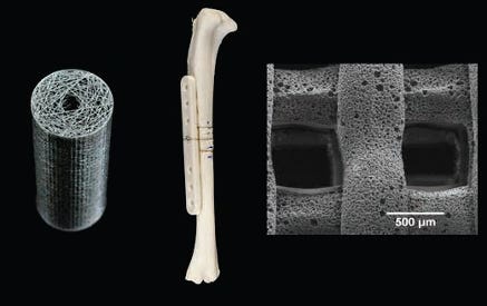 Customised 3D-Printed Bone Graft