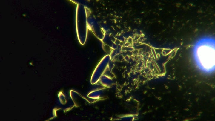 David nixon, urine forming strange shapes with no visible organelles.s.