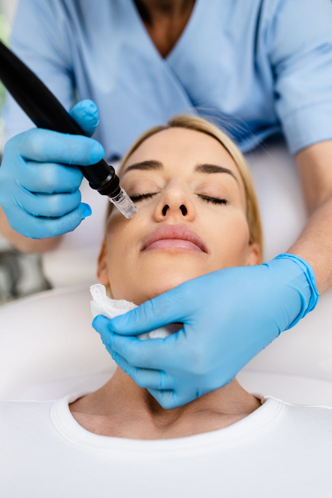 Microdermabrasion vs Microneedling