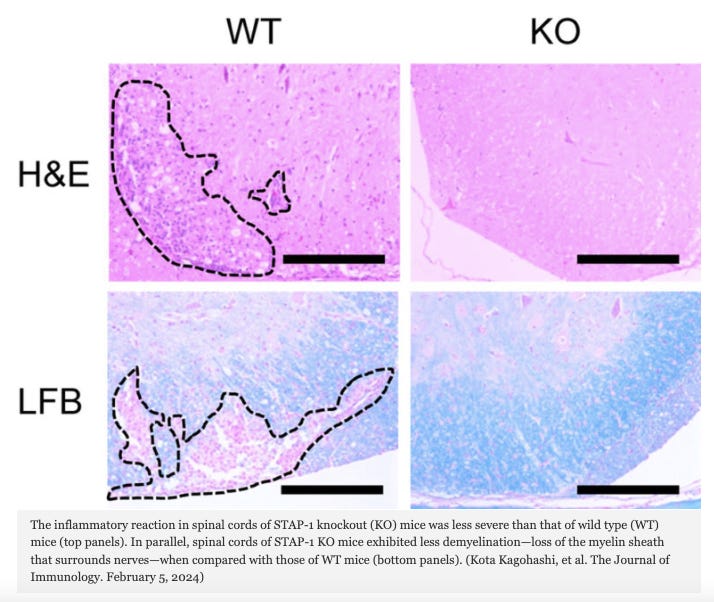 Key Protein Linked to Immune Disorders