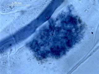Right: 450 million mycorrhizal fungi in ancient root cells. Left: Modern staining of mycorrhizal fungi in roots