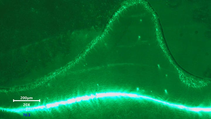 Laser scanning microscopy of gel like structures in blood. No noticeable activity after viewing these areas using a 532nm laser source for some time. These structures will usually expand and shrink on their own. A mata-material like wavy appearance can be seen aggrigated at the edges of the membrane.