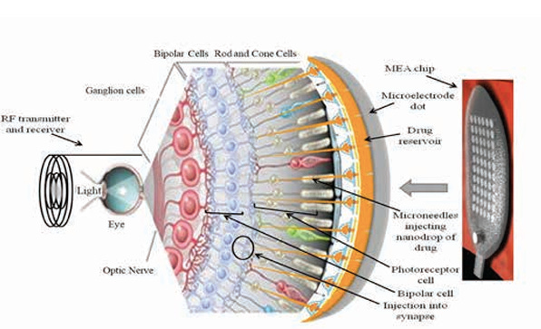 Chemoretina - Vision Restoration Using Voltage-Gated Sodium Channel Modulators